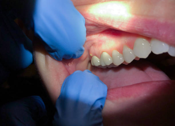 Best Weekend Emergency Dentist in Joshua, TX